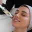 Micro Needling 